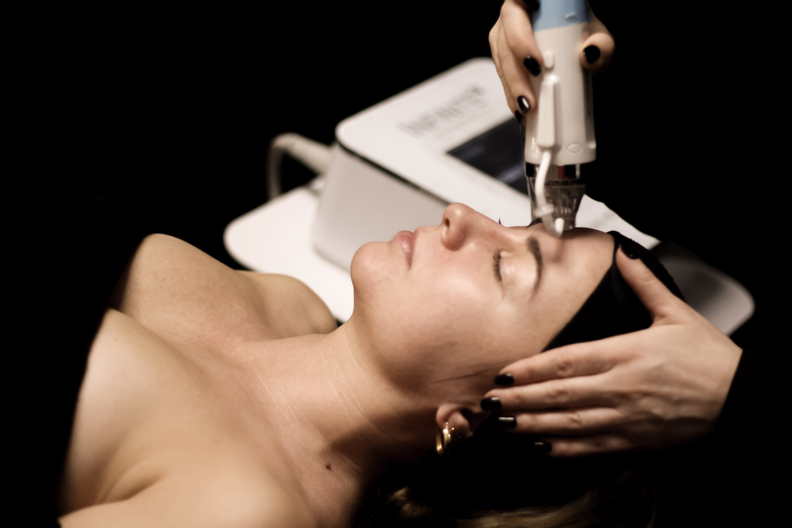 Zabieg i widoczne efekty